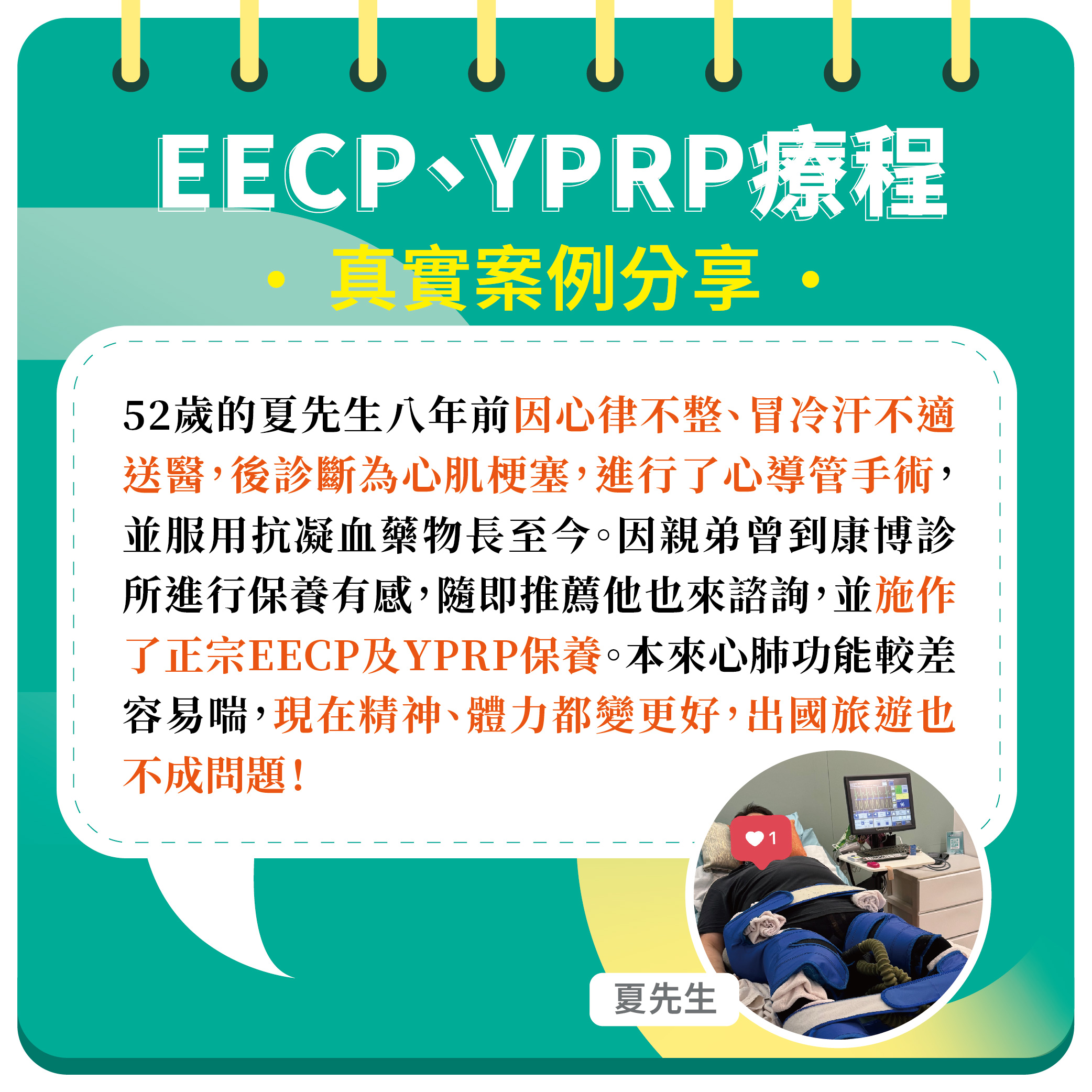 今年52歲的夏先生，因心律不整、血脂及血壓等問題，八年前診斷為心肌梗塞，目前使用抗凝血劑藥物已有八年以上，兩年前大腸癌三期化療結束。前來康博診所進行正宗EECP體外反博及YPRP保養，身體感受到明顯的改善！